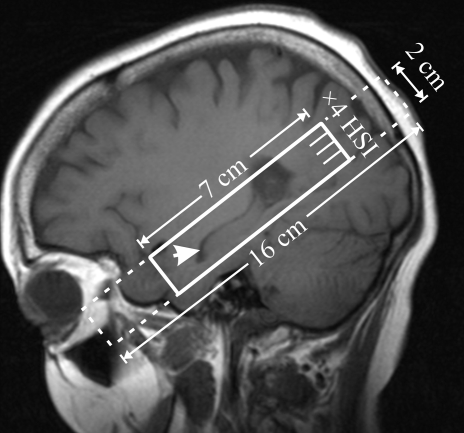 Figure 1a: