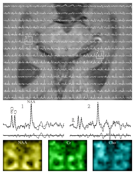 Figure 2: