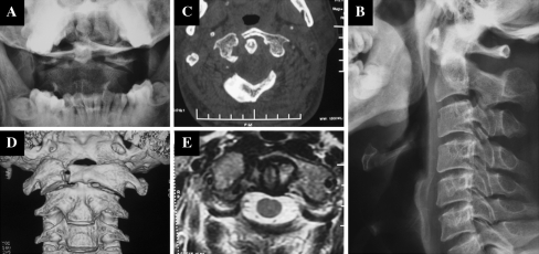 Fig. 1