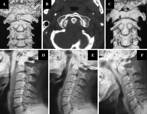 Fig. 3