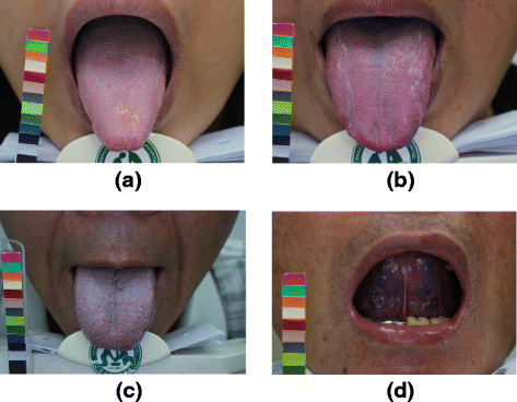 Fig. 2