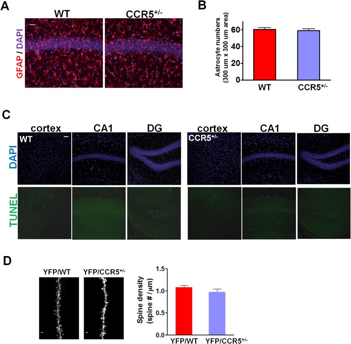 Figure 1—figure supplement 4.