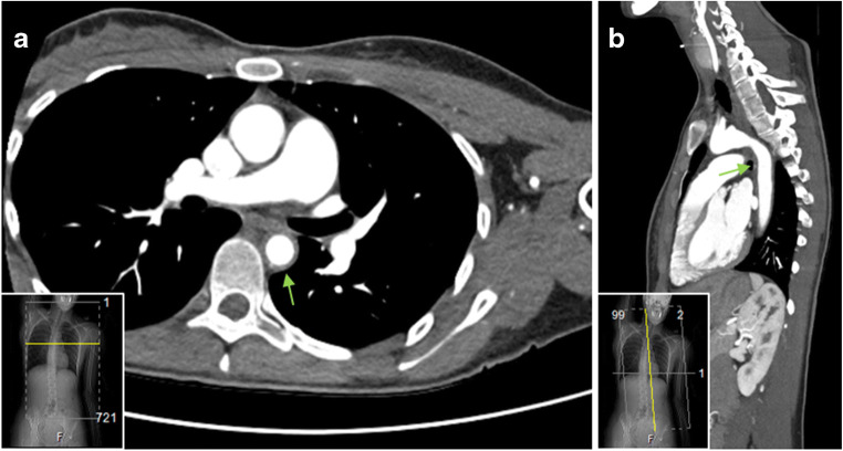 Fig. 5