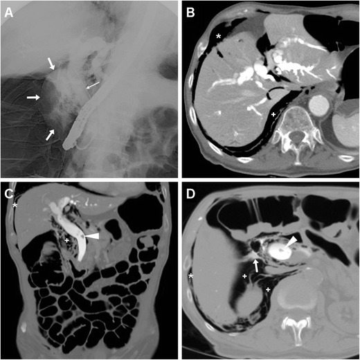 Fig. 11