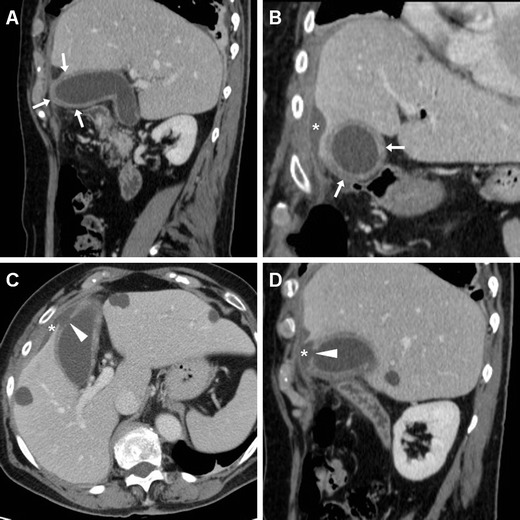 Fig. 15