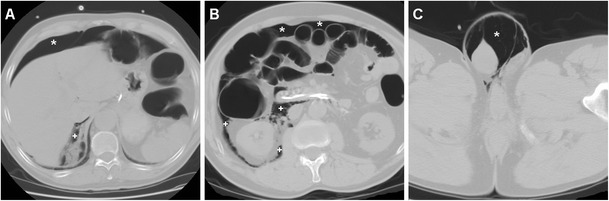 Fig. 14