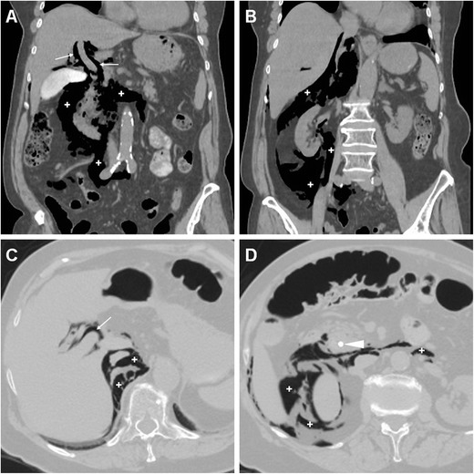 Fig. 12