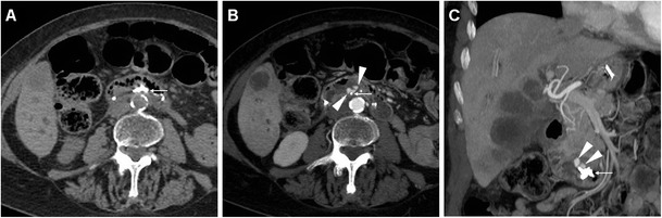 Fig. 9