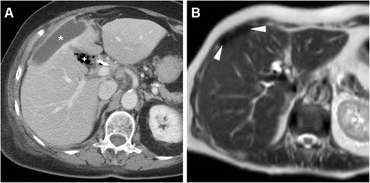 Fig. 17