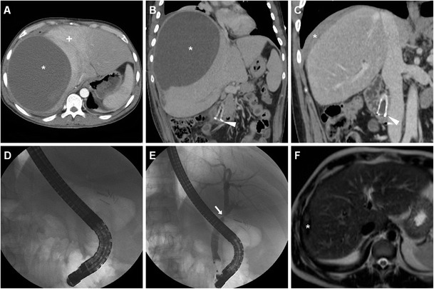 Fig. 18