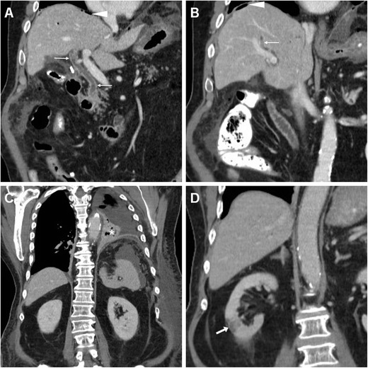 Fig. 16