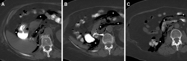 Fig. 1