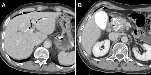 Fig. 19