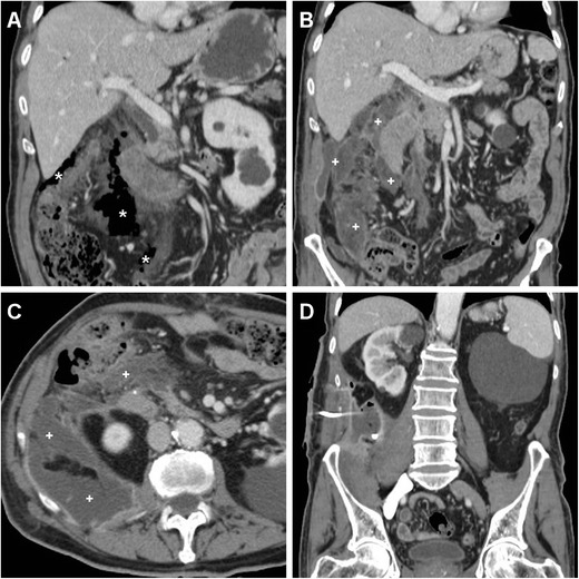 Fig. 13