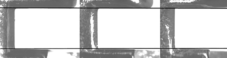 Figure 7. An ideal set of anterior straight wire brackets.