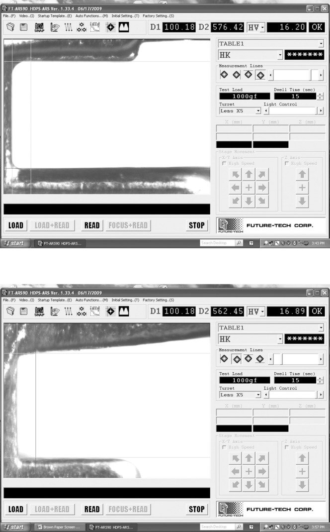 Figure 3. Two screenshots showing the vertical filars set at the base of the bracket and 100 µm apart down the slot. The horizontal filars are set perpendicular to the second vertical filar where it intercepts the bracket walls. The top screenshot depicts a bracket with rounded internal line angles and the lower screenshot a bracket with a divergent slot.