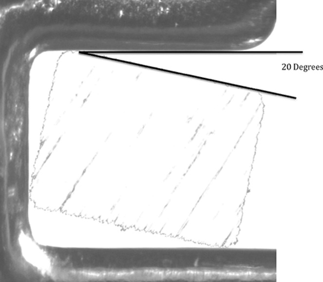 Figure 5. Depiction of a cross section of a polished 0.019- × 0.025-inch archwire that was imaged and scaled into the 0.022-inch slot of a bracket from our samples showing ±20° of slot play. Similar examples could be found in 0.018-inch slots as well.