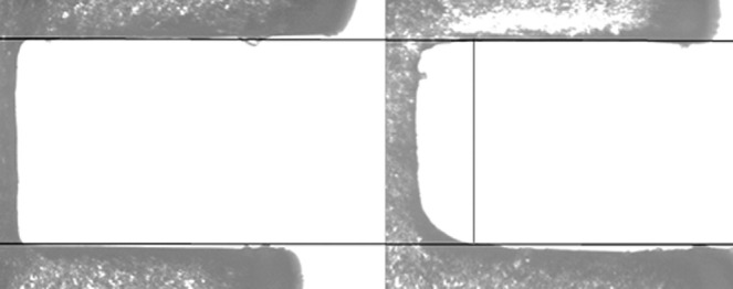 Figure 6. A right and left central incisor bracket from the same series. Not only would the same full-size wire not fit into the slot, a first-order discrepancy would also be introduced, due to a rounded lower corner on the right bracket.