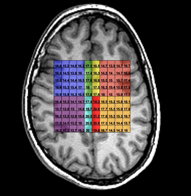 Figure 2.