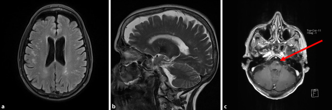 graphic file with name 115_2020_950_Fig1_HTML.jpg