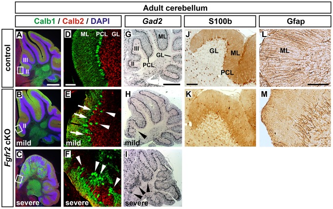 FGF/FGFR2 Signaling Regulates the Generation and Correct Positioning of ...