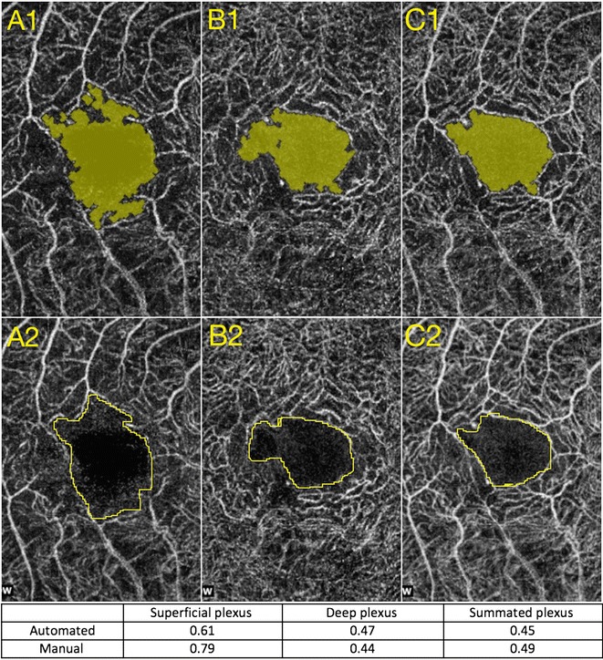 Fig. 2