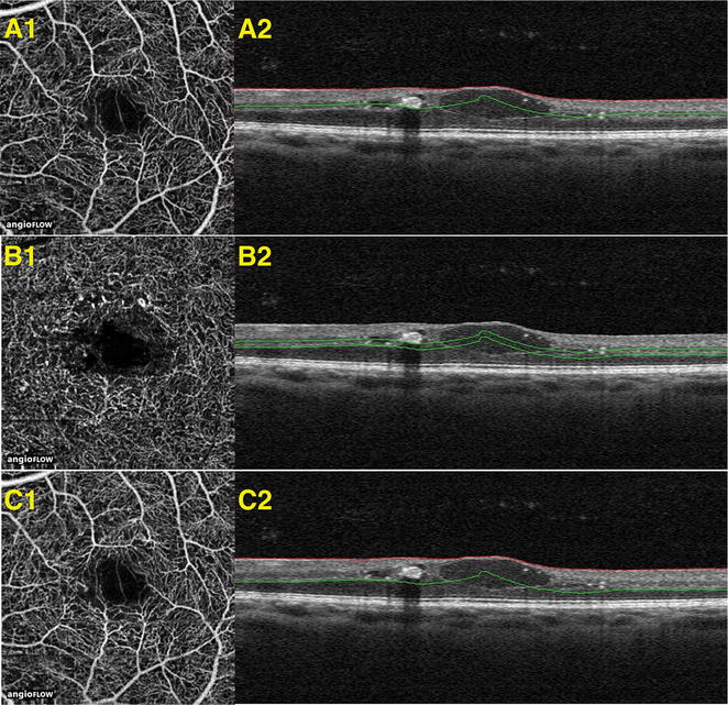 Fig. 1