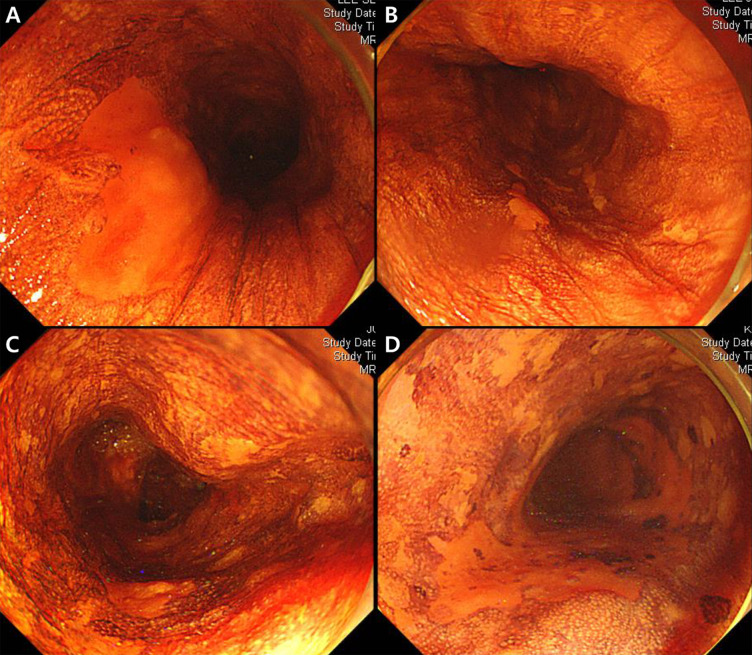 Fig 2