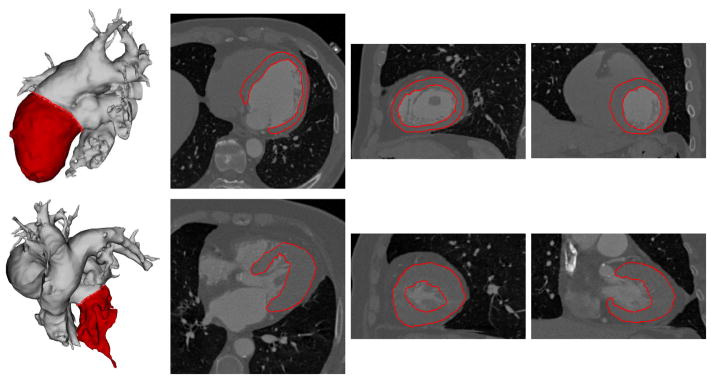 Fig. 10