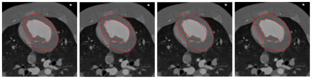 Fig. 12