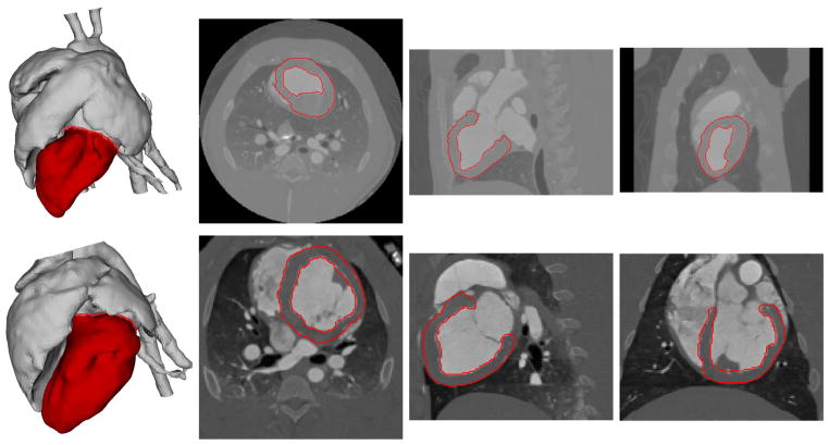 Fig. 11