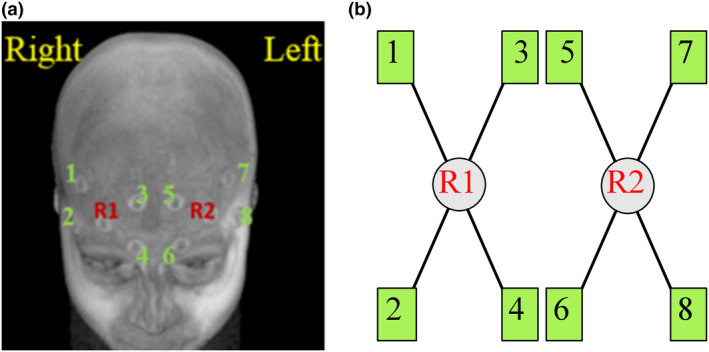 FIGURE 1