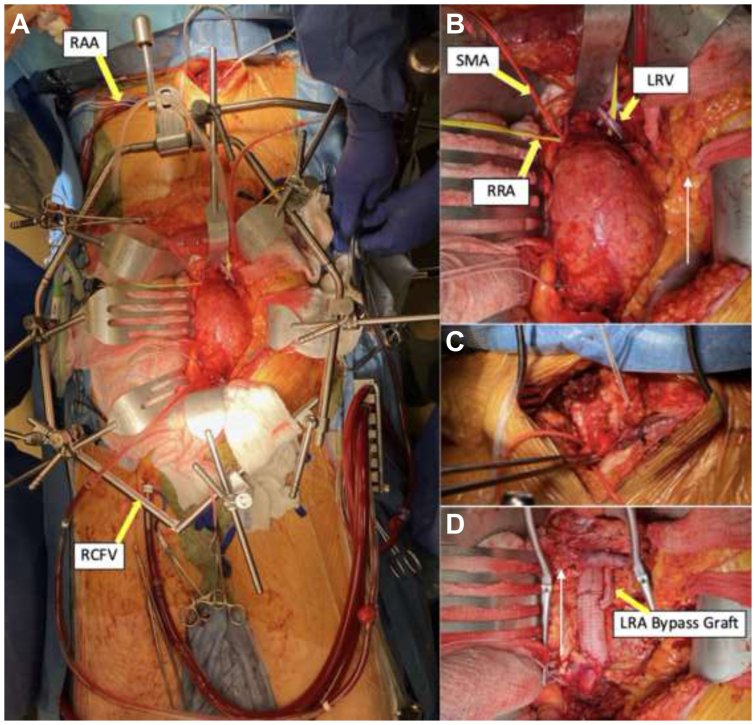 Fig 2