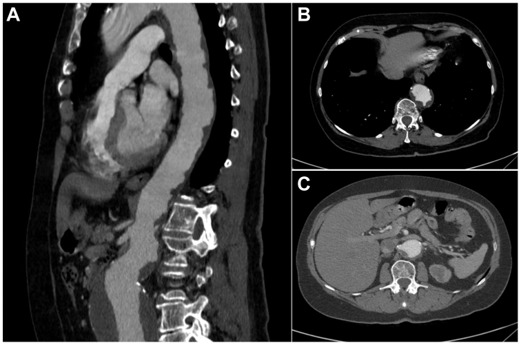 Fig 1