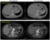 Fig 3