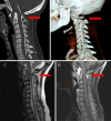 FIG. 1.