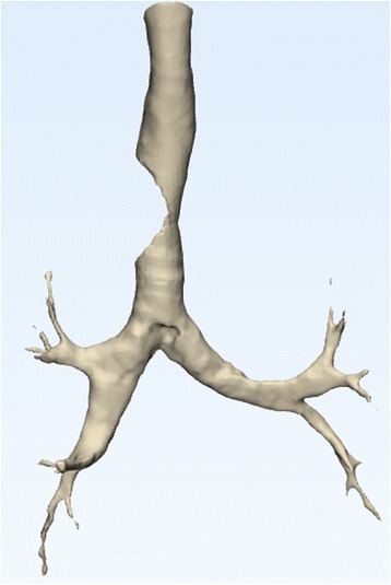 Fig. 29