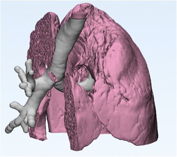 Fig. 26