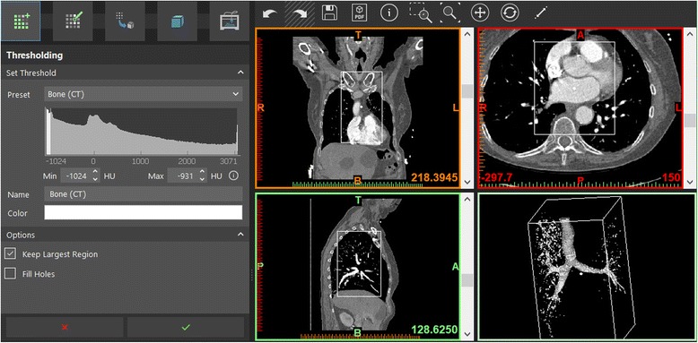 Fig. 13