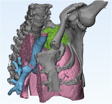 Fig. 25