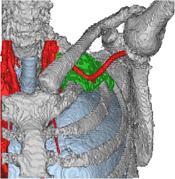 Fig. 14