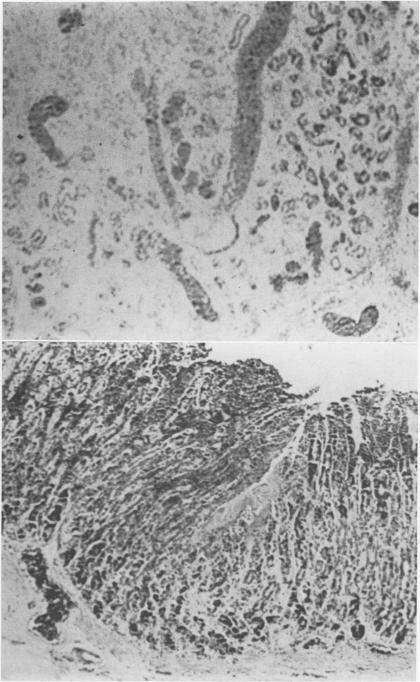 Fig. 1., Fig. 2.