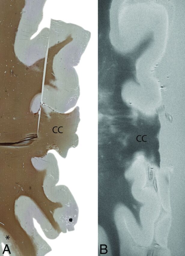 Fig 2.