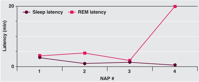 Fig 3.