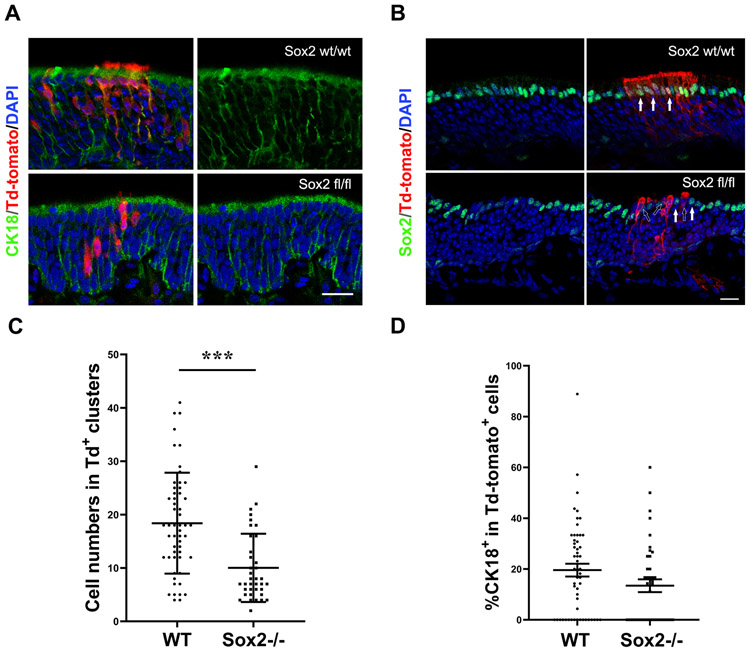 Sox2 regulates globose basal cell regeneration in the olfactory