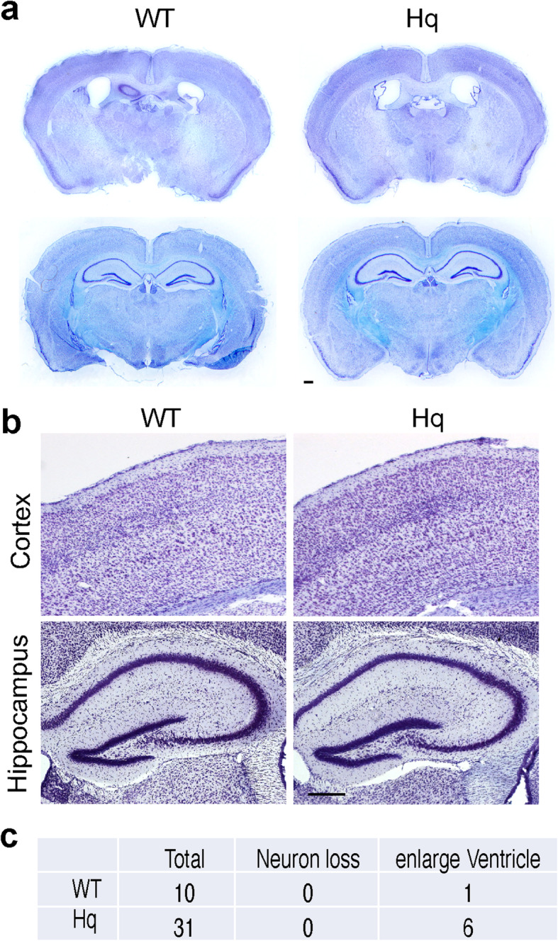 Fig. 11