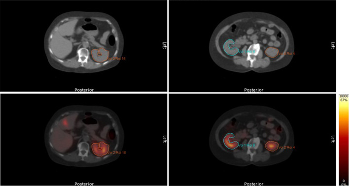 Fig. 2