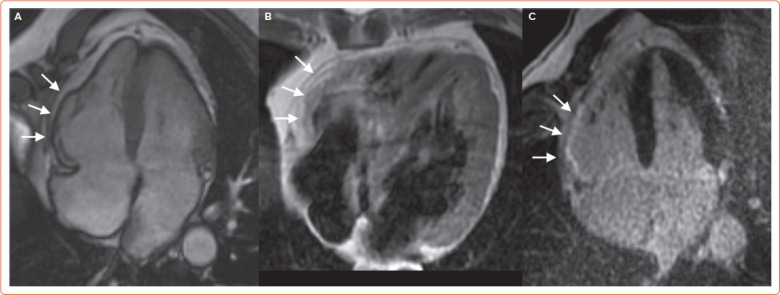 Figure 4: