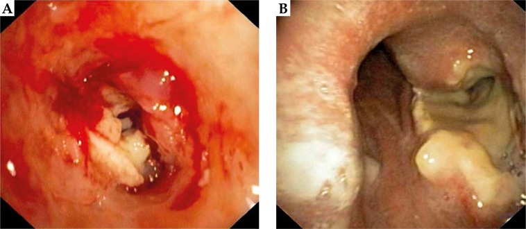 Fig. 12