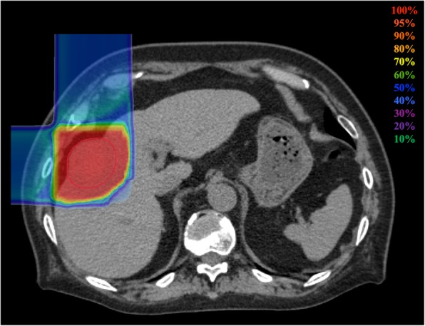 Fig. 1